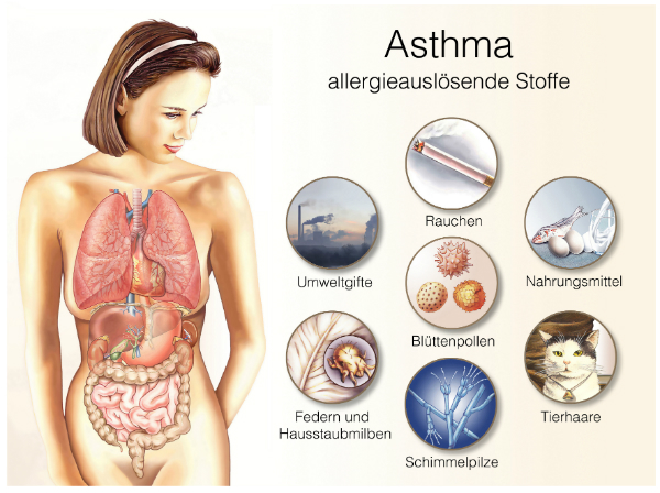 Asthma-Auslöser