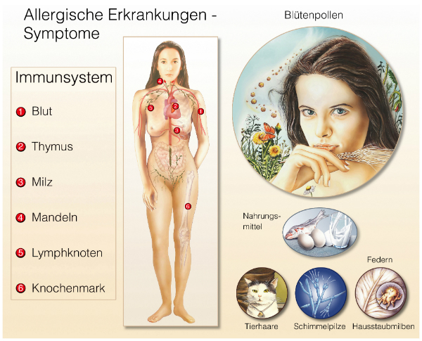 allergische-erkrankungen-symptome